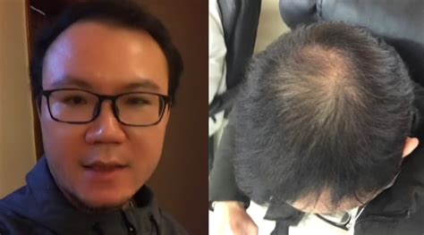 上海男子不用洗发水长出头发