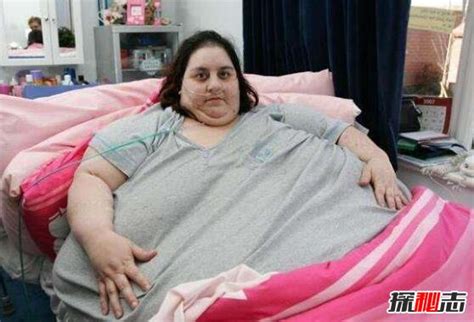世界上最胖的女人苏珊娜埃曼