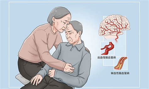 中老年人血管堵塞怎么运动