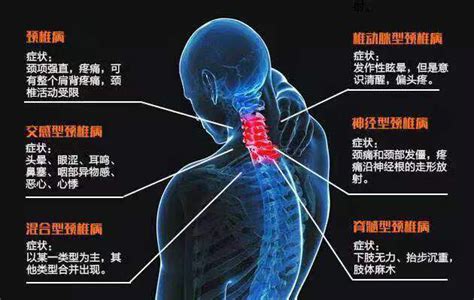 保护腰椎和颈椎的方法