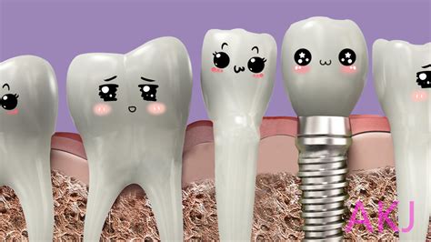 哪些牙齿不适合种植牙齿