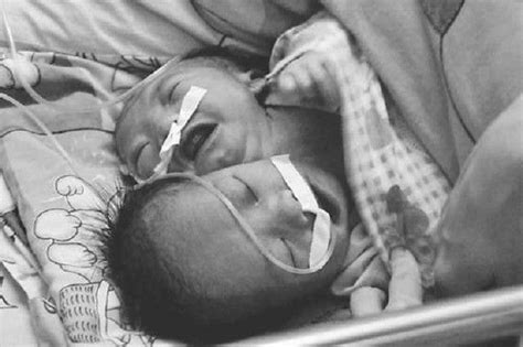 四川产妇生下孩子12小时后死亡