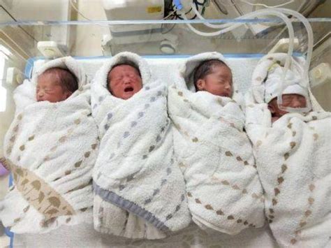 女子产下罕见四胞胎