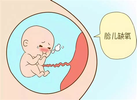 孕妇怎么知道宝宝缺氧