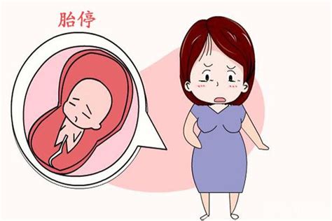 孕17周胎停有什么症状