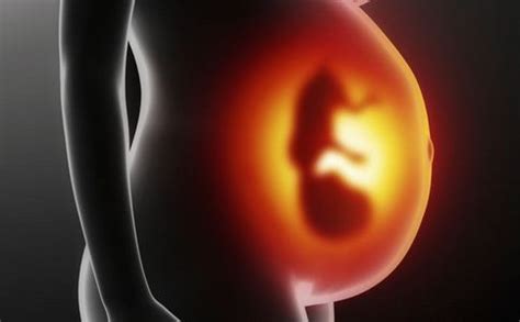 怀孕16周了胎停有什么症状
