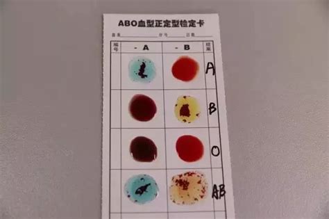 怎么测血型