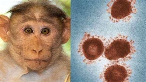 我国首次报告5例女性猴痘病例
