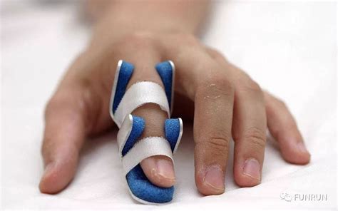 手指挫伤的最佳治疗方法