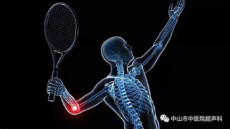 打乒乓球导致网球肘吗