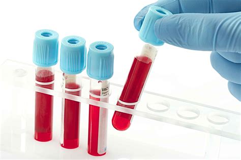 抽血化验检测公司