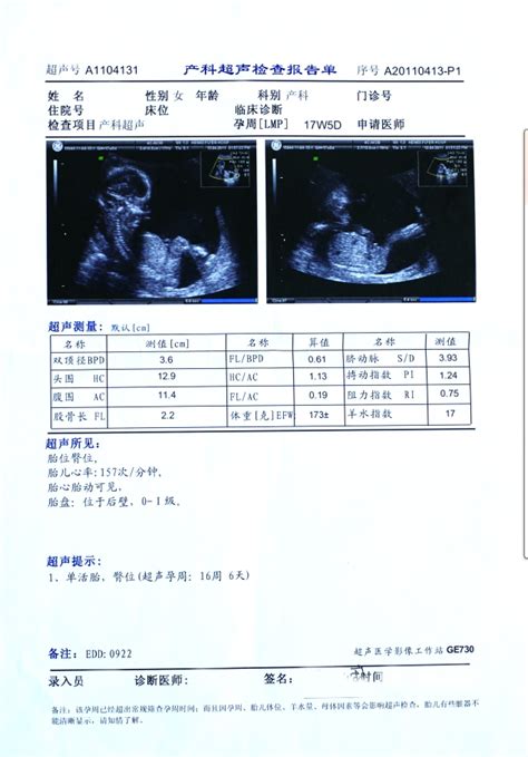 桂林市人民医院b超报告单