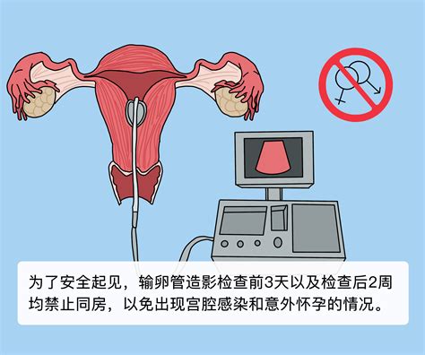 湘潭中心医院做输卵管造影多少钱