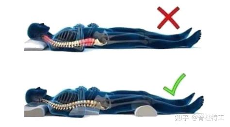 睡姿怎么对脊柱有帮助