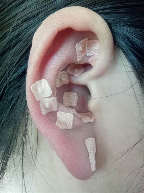 耳疗操作方法