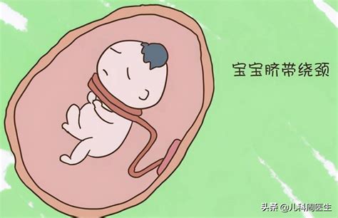 胎儿几周会脐带绕颈