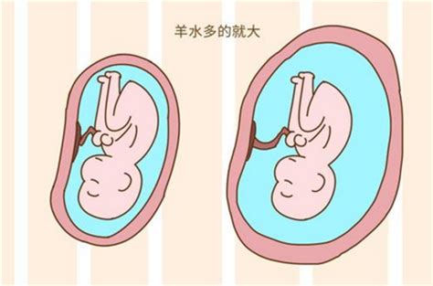 胎儿几周开始会出现畸形