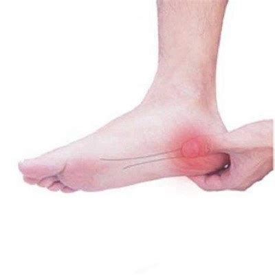 莫名其妙的脚痛是什么原因