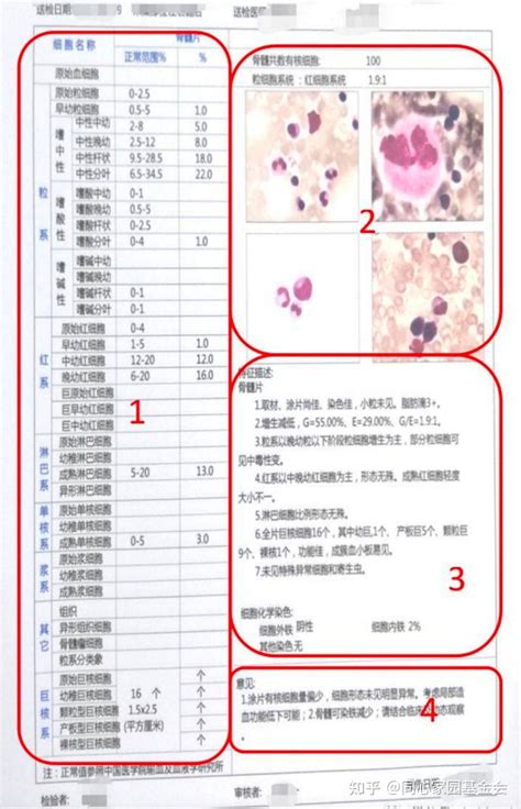 血检报告单是电脑识别吗