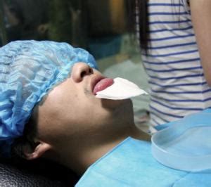 24岁女孩做舌头分叉手术