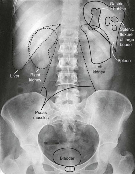 abdominal imaging